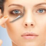 Keni rrathë të zinj poshtë syve, ja si t’i reduktoni